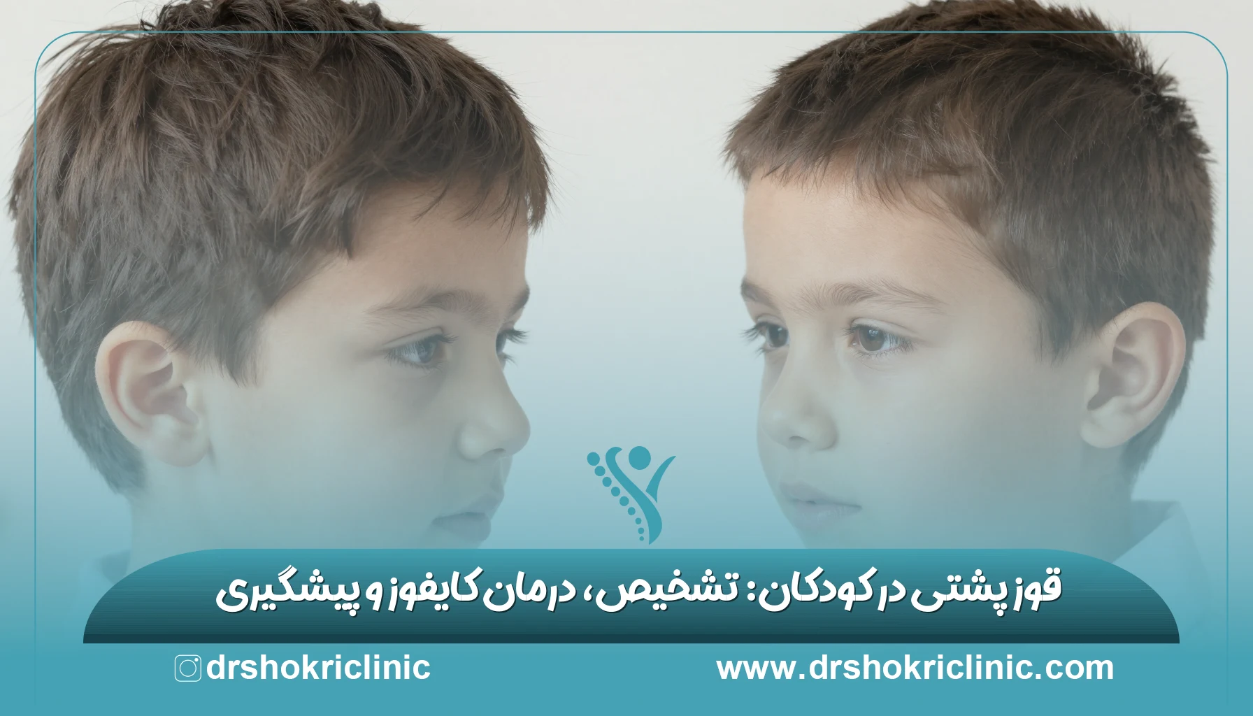 قوز پشتی در کودکان: تشخیص، درمان کایفوز و پیشگیری