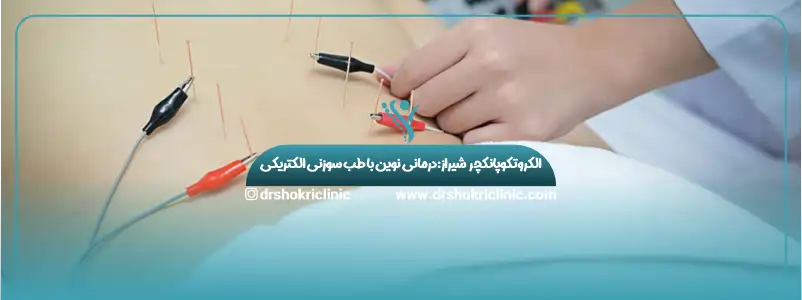الکروتکوپانکچر شیراز: درمانی نوین با طب سوزنی الکتریکی