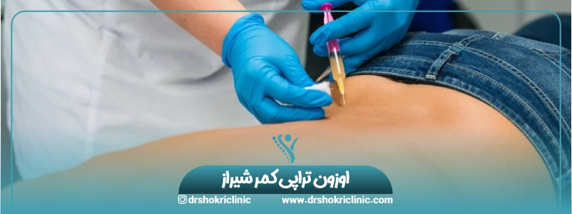 اوزون تراپی کمر شیراز