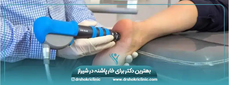 بهترین دکتر برای خار پاشنه در شیراز