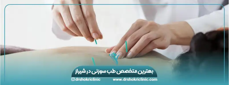 بهترین متخصص طب سوزنی در شیراز
