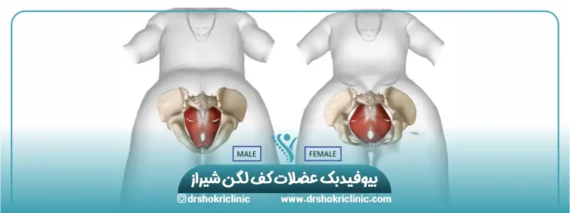 بیوفیدبک عضلات کف لگن شیراز2