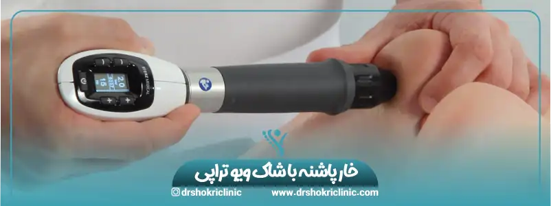 خار پاشنه با شاک ویو تراپی