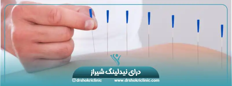 درای نیدلینگ در شیراز