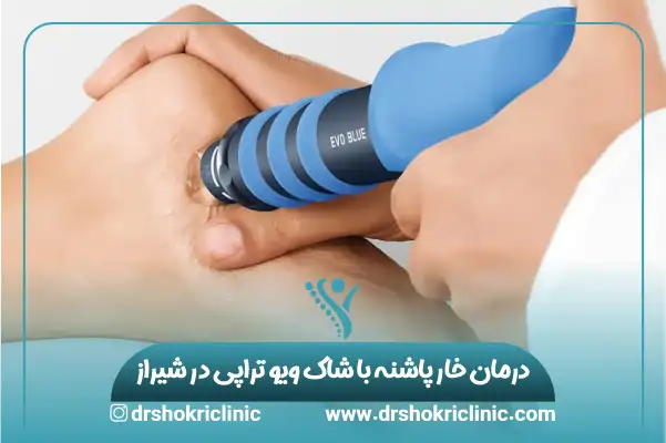 درمان خار پاشنه با شاک ویو تراپی در شیراز