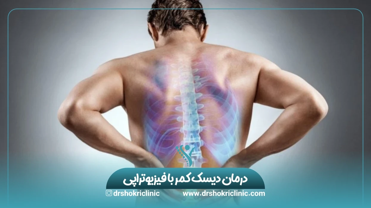 درمان دیسک کمر با فیزیوتراپی