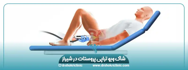 شاک ویو تراپی پروستات در شیراز