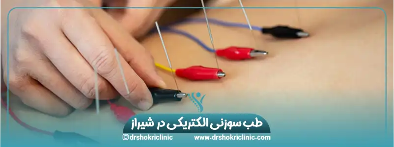 طب سوزنی الکتریکی دز شیراز 1