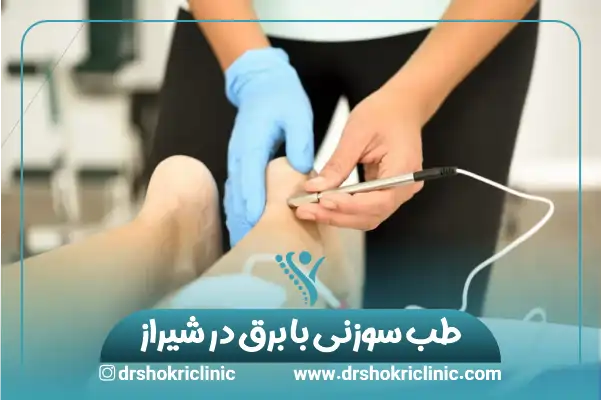 طب سوزنی با برق در شیراز + هزینه 1404✅ | درمانی نوین با پشتوانه علمی