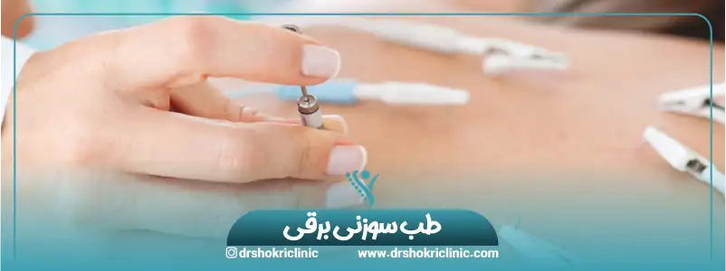 طب سوزنی برقی
