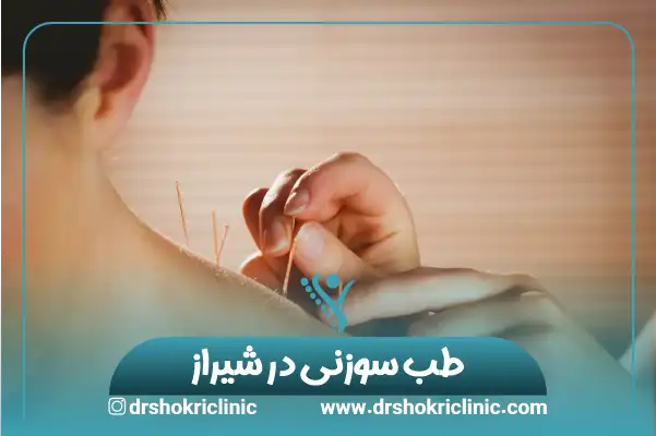 طب سوزنی در شیراز
