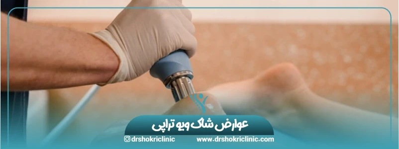 بررسی مهم‌ترین عوارض شاک ویو تراپی