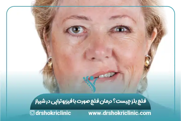 فلج بلز چیست؟ درمان فلج صورت با فیزیوتراپی در شیراز (1404)